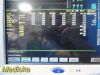SPACELABS 91370 Ultraview SL,W/ Leads, 91496 Module & PSU ~ Patient Monitor