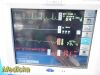 SPACELABS 91370 Ultraview SL,W/ Leads, 91496 Module & PSU ~ Patient Monitor
