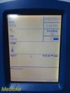 WELCH ALLYN 45NTO Spot Vital Signs LXI Monitor