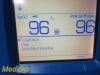 WELCH ALLYN 45NTO Spot Vital Signs LXI Monitor