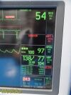GE 2006  Dash 4000 Series (Dual IBP SpO2 T/CO NBP EKG Print) Monitor