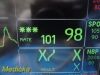 GE 2006  Dash 4000 Series (Dual IBP SpO2 T/CO NBP EKG Print) Monitor
