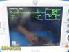 GE Dash 3000 Series Multi-parameter Patient Monitor