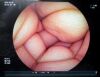 FUJIFILM EC-450BI5 Endoscope
