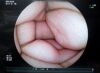 FUJIFILM EC-450WM Endoscope