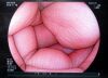 FUJIFILM EC-590ZP Endoscope