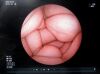 FUJIFILM EG-530N Endoscope