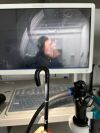 OLYMPUS GIF-HQ190 Gastroscope