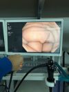 OLYMPUS GIF-H190 Gastroscope