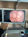 OLYMPUS BF1TH190 Bronchoscope