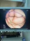 FUJINON EC-530WL Colonoscope