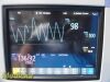 PHILIPS Intellivue MP5SC Spot Check Monitor