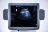 GE Logiq 7 Ultrasound Machine