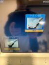 TOSHIBA Aplio 400 Ultrasound - OB / GYN
