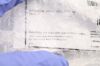 MEDLINE MDS3036623F | | EACHES | SPREADER, MODEL USA, PLASTER CAST, 9