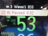 PHILIPS 2010  Intellivue MP30 , W/ MMS Module & NEW Leads~ Anesthesia Monitor