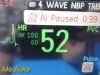 PHILIPS Intellivue MP50 Anesthesia Patient Monitor
