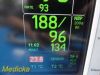 GE Dash 3000 Series,(Masimo SpO2) W/ NEW Patient Leads ~ Patient Monitor