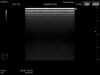HITACHI EUP-L52 Ultrasound Transducer