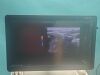 GE Logiq E9 XDclear 2.0  Ultrasound Machine (DOM: 2018) w/ GE IC5-9-D, GE 9L-D