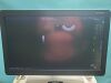 GE Logiq E9 XDclear 2.0  Ultrasound Machine (DOM: 2018) w/ GE IC5-9-D, GE 9L-D