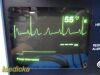 WELCH ALLYN Protocol 6200 Series Patient Monitor