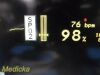 SPACELABS 90309 Vital Signs Patient Monitor