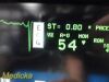 SPACELABS 90309 Vital Signs Patient Monitor