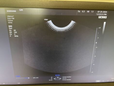 SAMSUNG HS60 Ultrasound