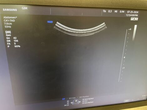 SAMSUNG HS60 Ultrasound