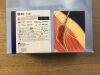 BD TKM1115 Trek Powered Bone Biopsy System 11G x 15cm (X)