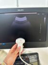 PHILIPS EPIQ 5G / YOM: 2014
