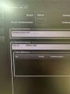 PHILIPS EPIQ 5G / YOM: 2014