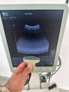 BK MEDICAL Flex Focus 500 Ultrasound - Urology