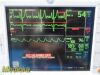 GE Dash 3000 Series (Dual IBP SpO2 EKG NBP T/CO Print) Monitor