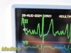 GE Dash 3000 Series (Dual IBP SpO2 EKG NBP T/CO Print) Monitor