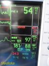 GE Dash 3000 Series (Dual IBP SpO2 EKG NBP T/CO Print) Monitor