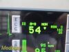 SPACELABS 91369 Ultraview SL Patient Monitor