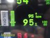 SPACELABS 91369 Ultraview SL Patient Monitor