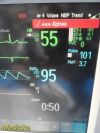 PHILIPS Intellivue MP20,Ref M8001A W/ M3001A MMS Module & Leads ~ Monitor