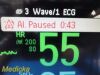 PHILIPS 2012  Intellivue MP30,W/ 3001A MMS Module/Leads~ Anesthesia Monitor