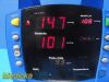 GE/DINAMAP 2006 GE Procare DPC420N-EN Patient Monitor