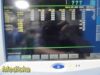 SPACELABS 91370 Ultraview SL Patient Monitor