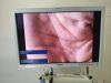 OLYMPUS Visera Elite Endoscopy Tower