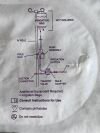 BARD Hydro-Surg Plus  0026870  Exp.2026-09 to 2027-02  (H56/Y72/Y76) Hydro-Surg Plus