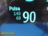 PHILIPS 2012  Intellivue MP30 Neonatal, W/ 3001A MMS Module & Leads~ Monitor