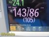 PHILIPS 2012  Intellivue MP30 Neonatal, W/ 3001A MMS Module & Leads~ Monitor