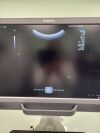 SIEMENS Acuson 8C3HD Ultrasound Transducer