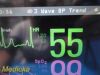 PHILIPS Intellivue MP50  , MMS Press Print Modules, Leads~ Anesthesia Monitor