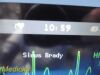 PHILIPS Intellivue MP50  , MMS Press Print Modules, Leads~ Anesthesia Monitor